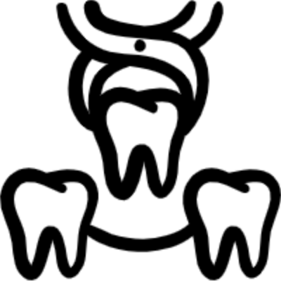 Extracción dental