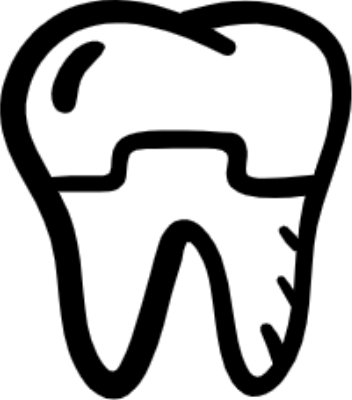 Corona dental de cerámica